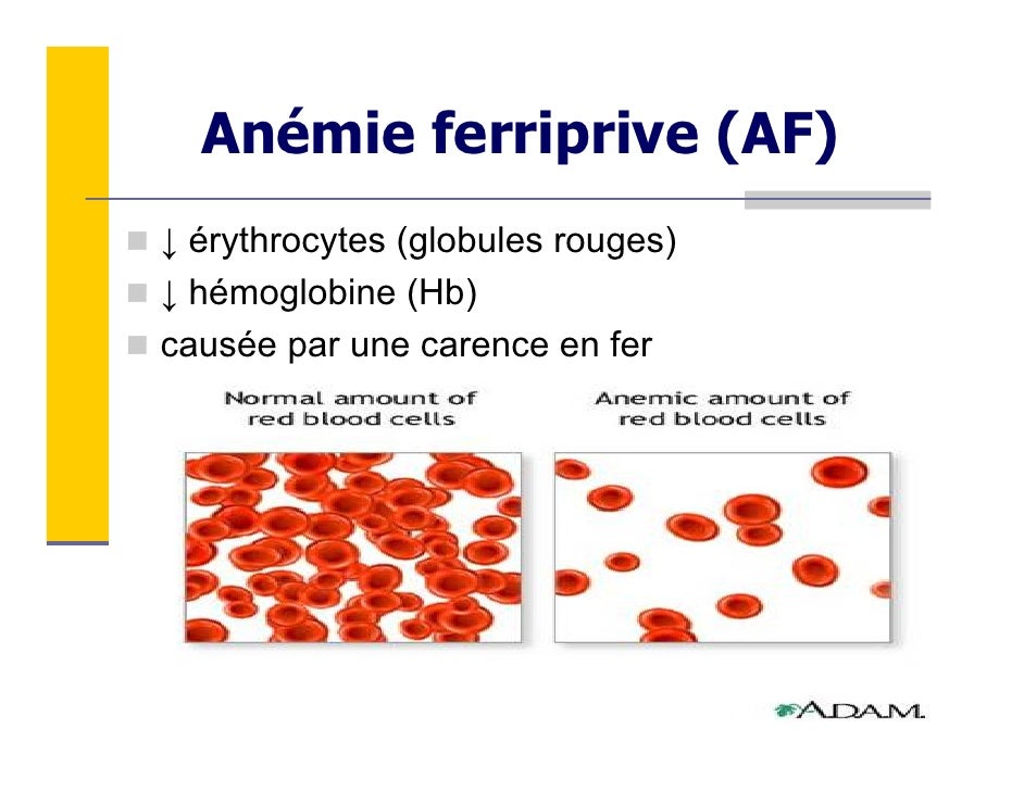 anémie fer conséquences anémie fer conséquences